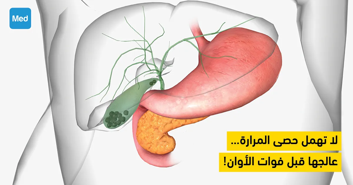 لا تهمل حصى المرارة... عالجها قبل فوات الأوان!